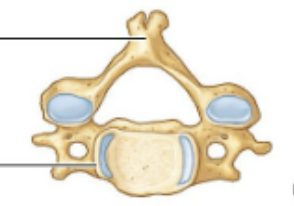 <p>identify this vertebrae</p>