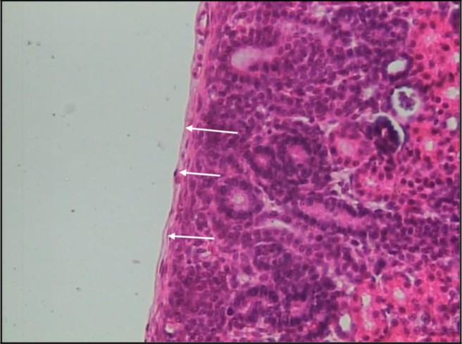 <p>Simple Squamous epithelium</p>