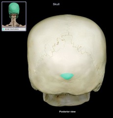 <p>bump on back of head (feature)</p>
