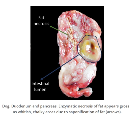 <ul><li><p>The death of fat cells.</p><ul><li><p>Stored fat breaks down into glycerol and fatty acids, which then react with minerals like calcium, potassium, or sodium to form soaps.</p><ul><li><p>A process called <strong>saponification</strong>.</p></li></ul></li></ul></li><li><p>Necrotic fat appears opaque, firm, and white.</p></li></ul><p></p>