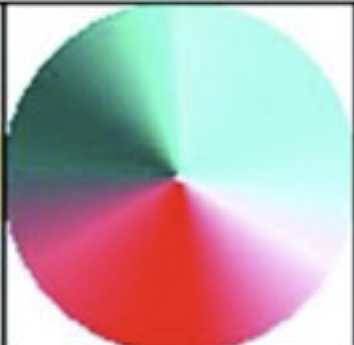 <p>Someone with [blank] is an individual who suffers from color blindness that is due to the absence of S cones</p>