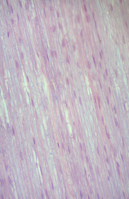 <p>what type of tissue?</p>