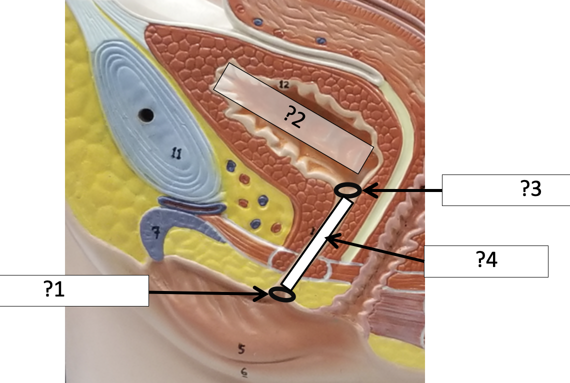 <p>4 Name the structure?</p>