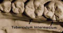<p>What term describes an extra lingual cusp on a mandibular molar?</p>