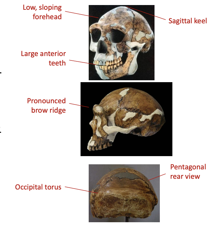 <ul><li><p>larger and more robust than <em>Homo habilis</em></p></li><li><p>longer legs - body proportions similar similar to modern humans </p></li><li><p>larger brain (950cc)</p></li><li><p>classic cranial features:</p><ul><li><p>low forehead</p></li><li><p>pronounced browridge</p></li><li><p>large anterior teeth</p></li><li><p>small back teeth</p></li><li><p>sagittal keel</p></li><li><p>occipital torus (<span>a thickened, horizontal band of bone on the occipital bone at the back of the skull, often appearing as a prominent ridge or bump)</span></p></li><li><p>pentagonal rear view</p></li></ul></li><li><p>shovel shaped incisors</p></li><li><p>classic features more pronounced in Asian examples</p></li></ul><p></p>