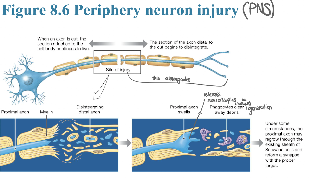 <p>• If the cell body dies, the neuron dies</p><p>• If axon is severed, then cell body and attached segment survives; severed portion degenerates</p><p>– If its damaged motor neuron, then target muscle results in permanent paralysis</p><p>– If sensory neuron, then experience loss of sensation from innervated area</p><p><strong><u>• Regeneration may occur in PNS; less likely in CNS</u></strong></p><p></p>