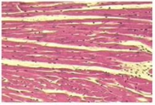 <p>what kind of cardiac muscle injury?</p>