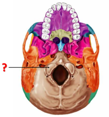<p>Identify this structure.</p>