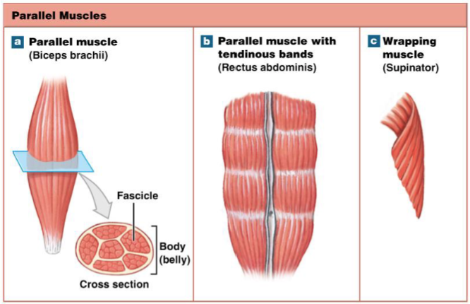 <p>What muscle type increases in diameter as it contracts?</p>