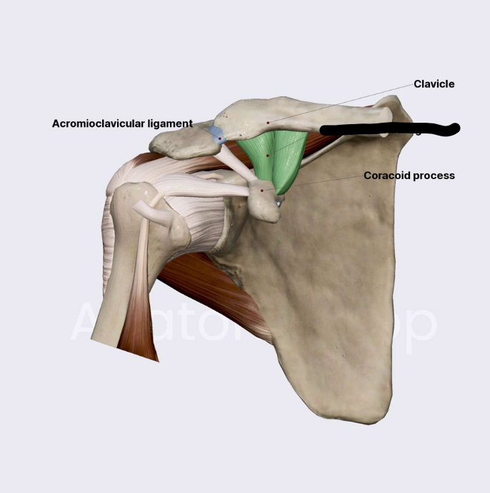 <p>What Shoulder Ligament?</p>