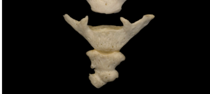 <p>what bone is being shown</p>