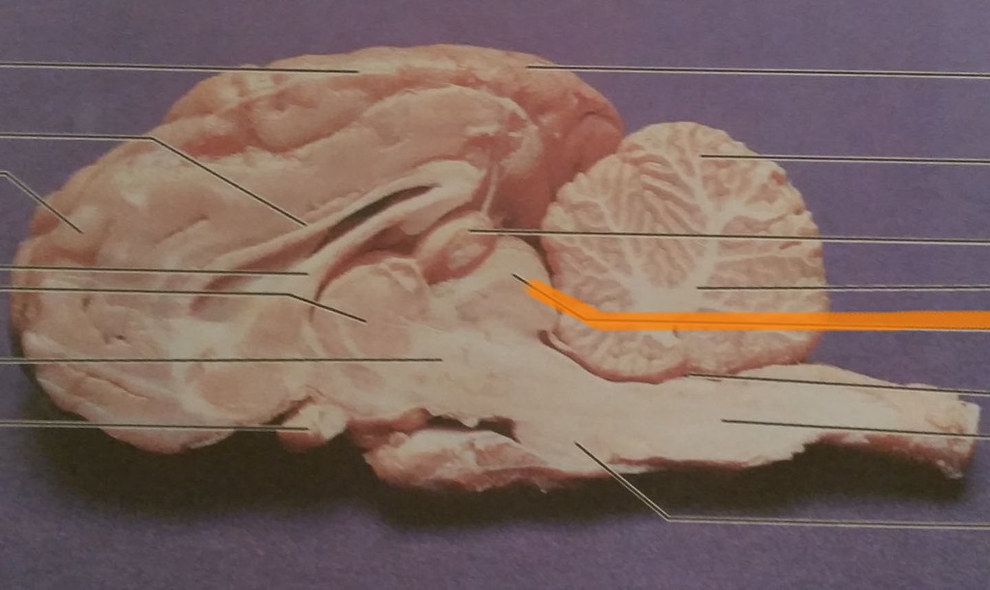 <p>dorsal midbrain</p>