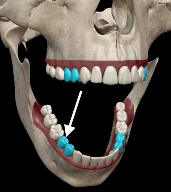 <p>What tooth is this in correct Tooth Notation form?</p>