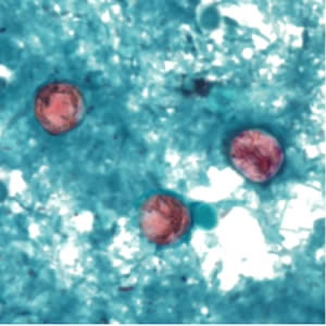 <p>Modified Acid Fast Stain</p><p>Associated with Rasberries and basil</p>