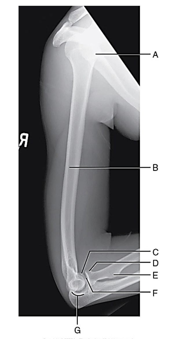 <p>C?</p>