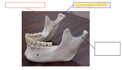 <p>Mandible</p>