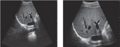<p>we change our imaging depth</p>
