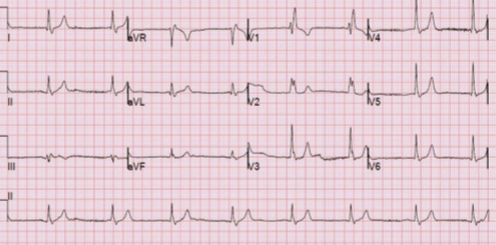 <p>What is this rhythm?</p>