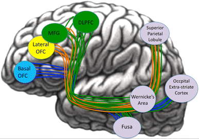 <p>Witte stofbaan die de inferieur frontale gyrus verbindt met de occipito-temporale cortex; onderdeel van de ventrale route en betrokken bij snelle, directe woordherkenning.</p>