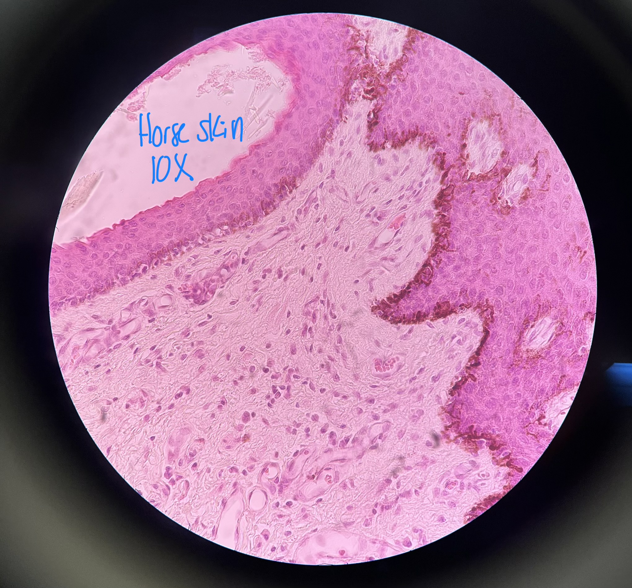 <p>What cell inclusion is shown on the basement membrane of the dermis?</p>