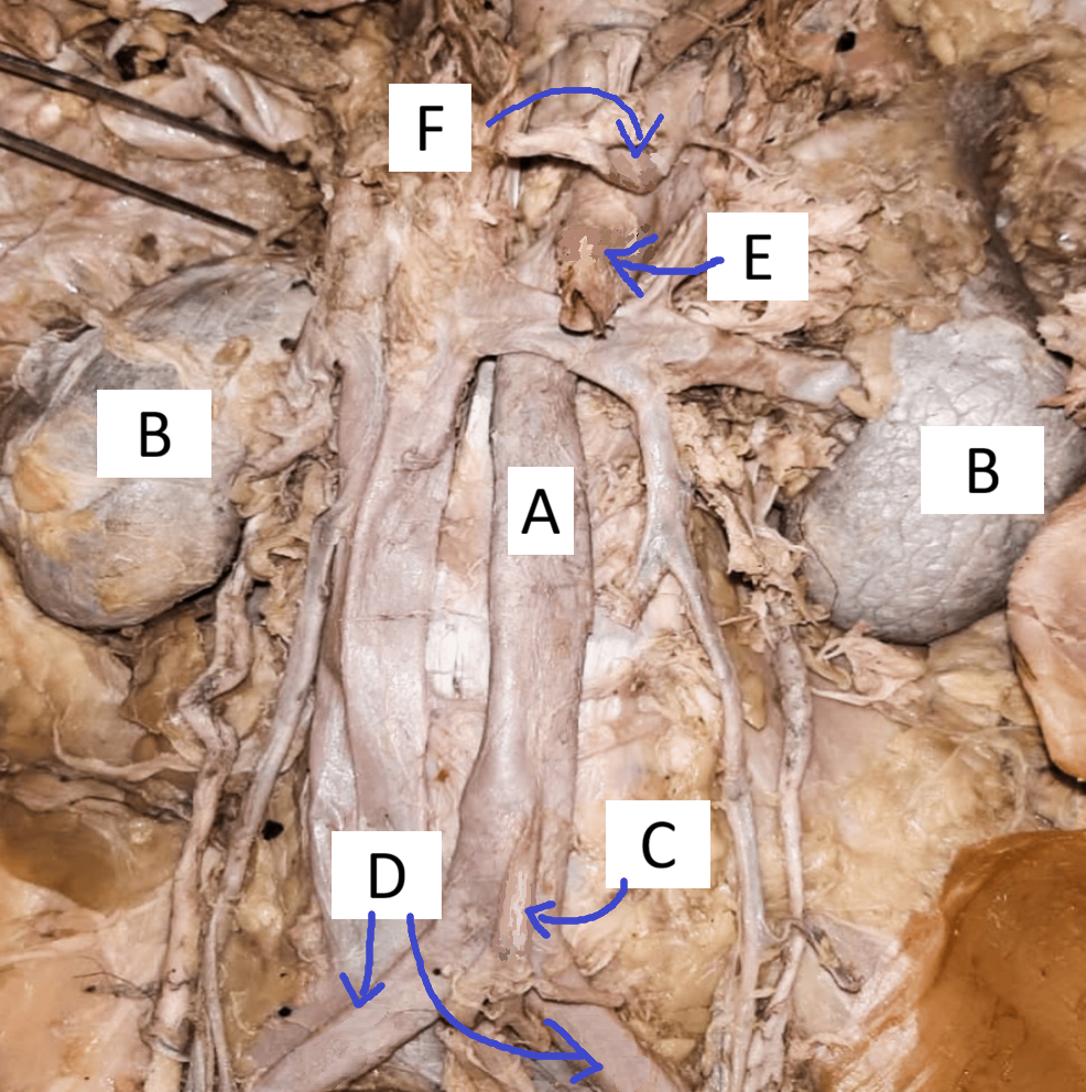 <p>B</p>