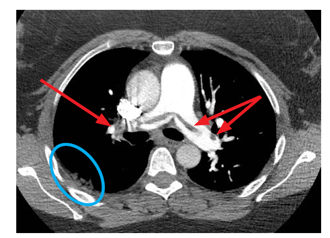 <p>What is the red arrows?</p>