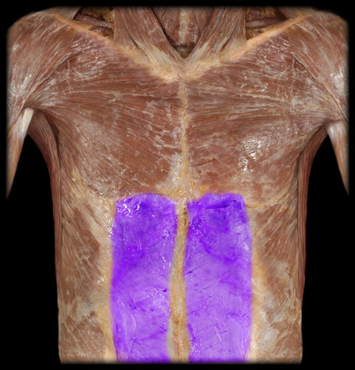 <p>Aponeurotic sheath surrounding rectus abdominis.</p>
