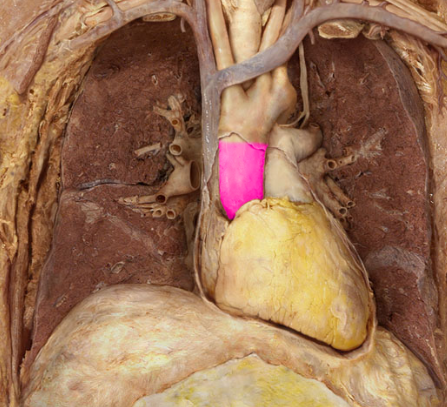 <p>coronary arteries, right and left</p>