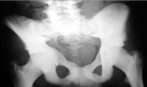 <p>What is the pathology?</p>
