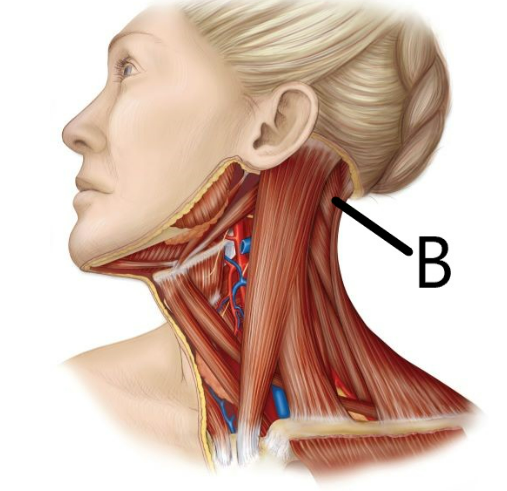 <p>what is this neck muscle</p>