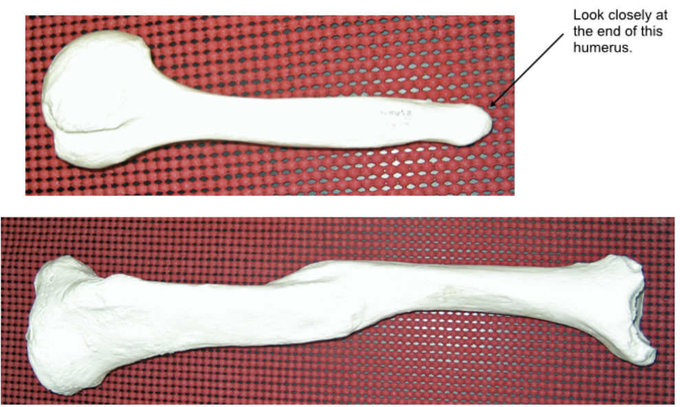 <p>is this injury antemortem, perimortem, or postmortem?</p>