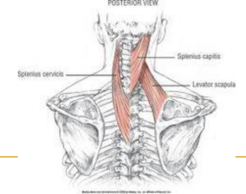 <p>O: mastoid process and lateral third of superior nuchal line</p><p>I: nuchal ligament & C7-T6 spinous processes</p><p>N: dorsal rami middle cervical spinal nerves</p><ul><li><p>unilarerally: ipsilat side bend / neck rotation</p></li><li><p>Bilat: extension of head/neck</p></li></ul><p>visually blend with cervicis</p><p></p>