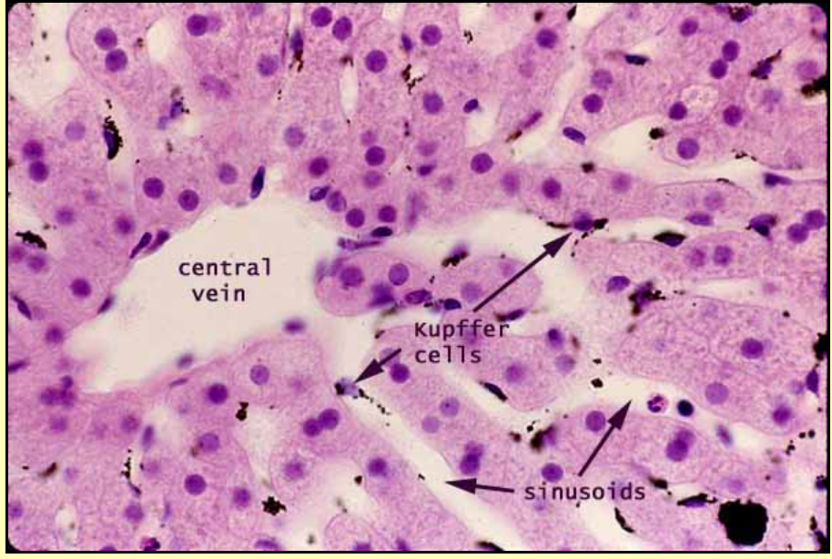 <p>-Liver</p><p>-Hepatocyte is the predominant cell</p><p>-Portal triads with central vein (the big white circles)</p><p>-Sinusoids are the spaces between the rows of hepatocytes </p><p>-Kupffer cells in sinusoids </p>