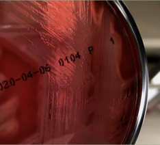 <p>Make an observation, what type of hemolysis is this?</p>