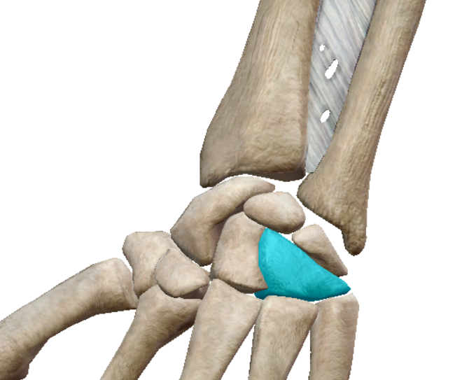 term image