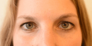 <p>Cheek Raiser</p>