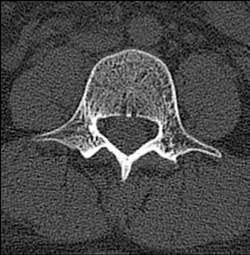 <p><span>腰椎</span></p>