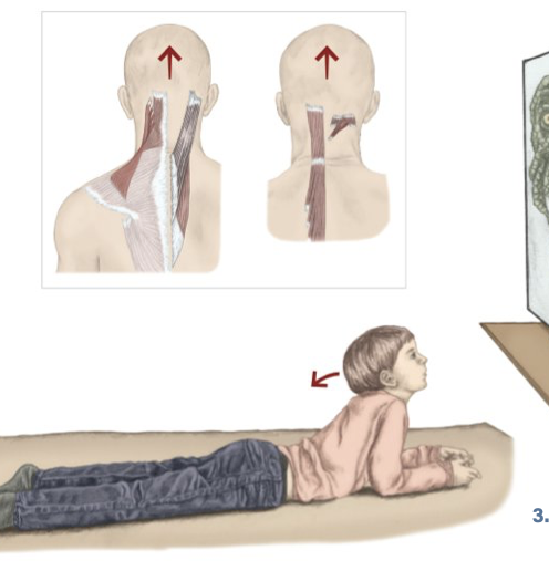 <p>Neck Extension assists</p>