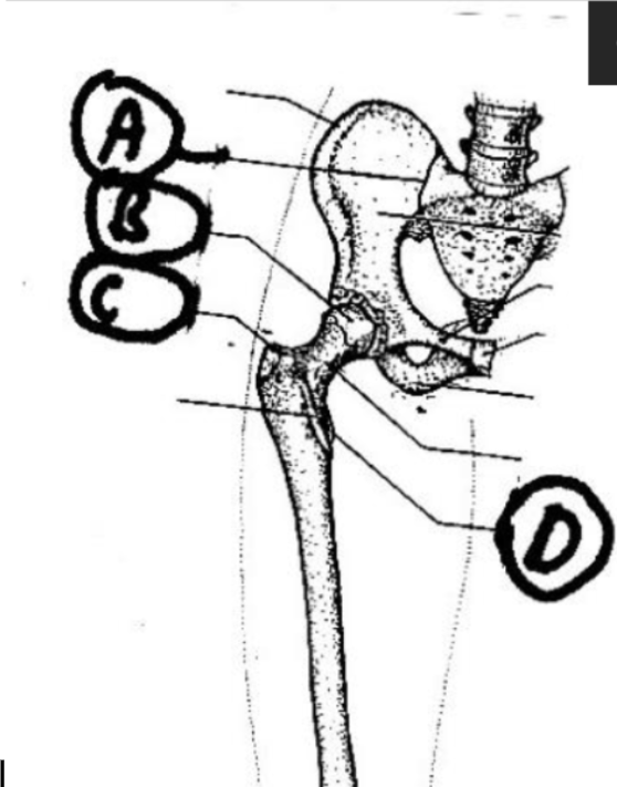 <ol start="4"><li><p>D</p></li></ol><p>FYI:</p><p>A: SI joint</p><p>B: Femoral head-Acetabulum </p><p>C: Greater Trochanter </p><p></p>