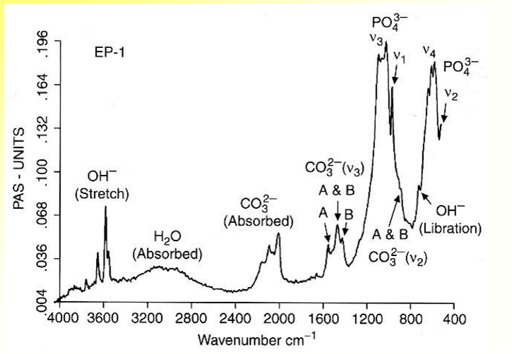 <p>used instead of X-ray diffraction (???); uses absorbance to define chemical groups in the sample</p>