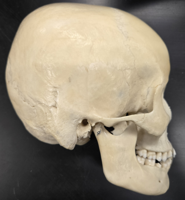 <p>frontal bone, coronal suture, parietal bone, squamosal suture, temporal bone (zygomatic process, external auditory meatus, mandibular fossa), zygomatic bone (temporal process), maxillary bone, occipital bone, lambdoidal suture, mandible (mandibular condyle)</p>