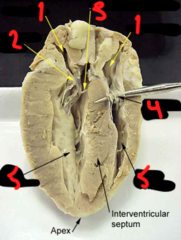 <p>what is 1?</p>