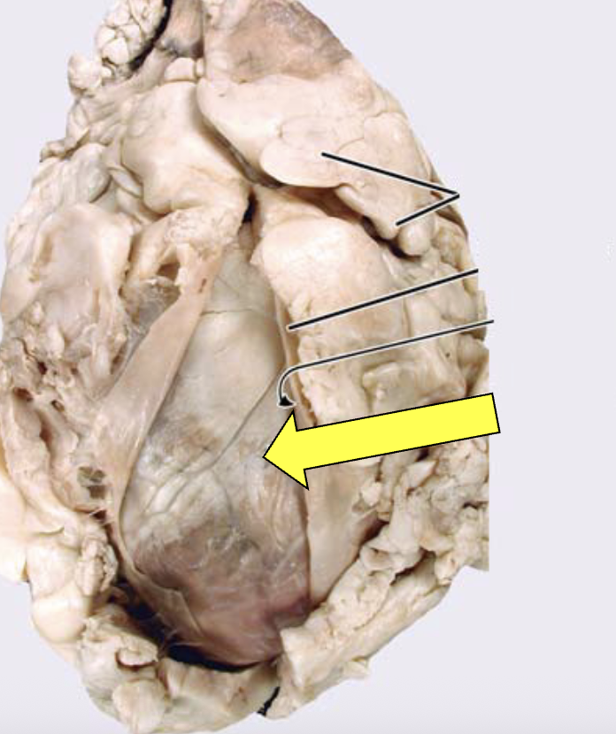 <p>epicardium (visceral pericardium) </p>