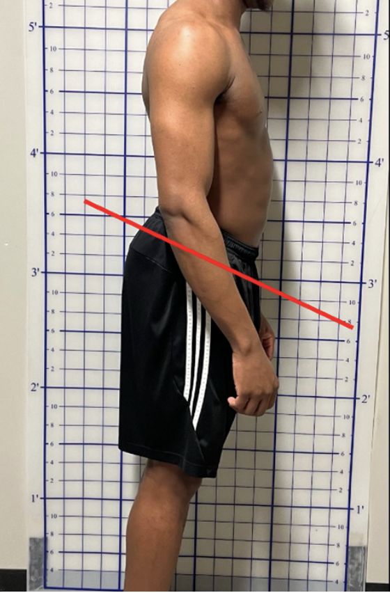 <p>anterior pelvic tilt: fix</p>
