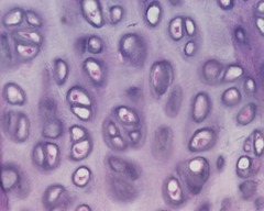 <p>most abundant type of cartilage; short and dispersed collagen fibers</p><p>- forms moveable joints and embryonic skeleton</p><p>- found on the ends of long bones, ribs, and nose</p>