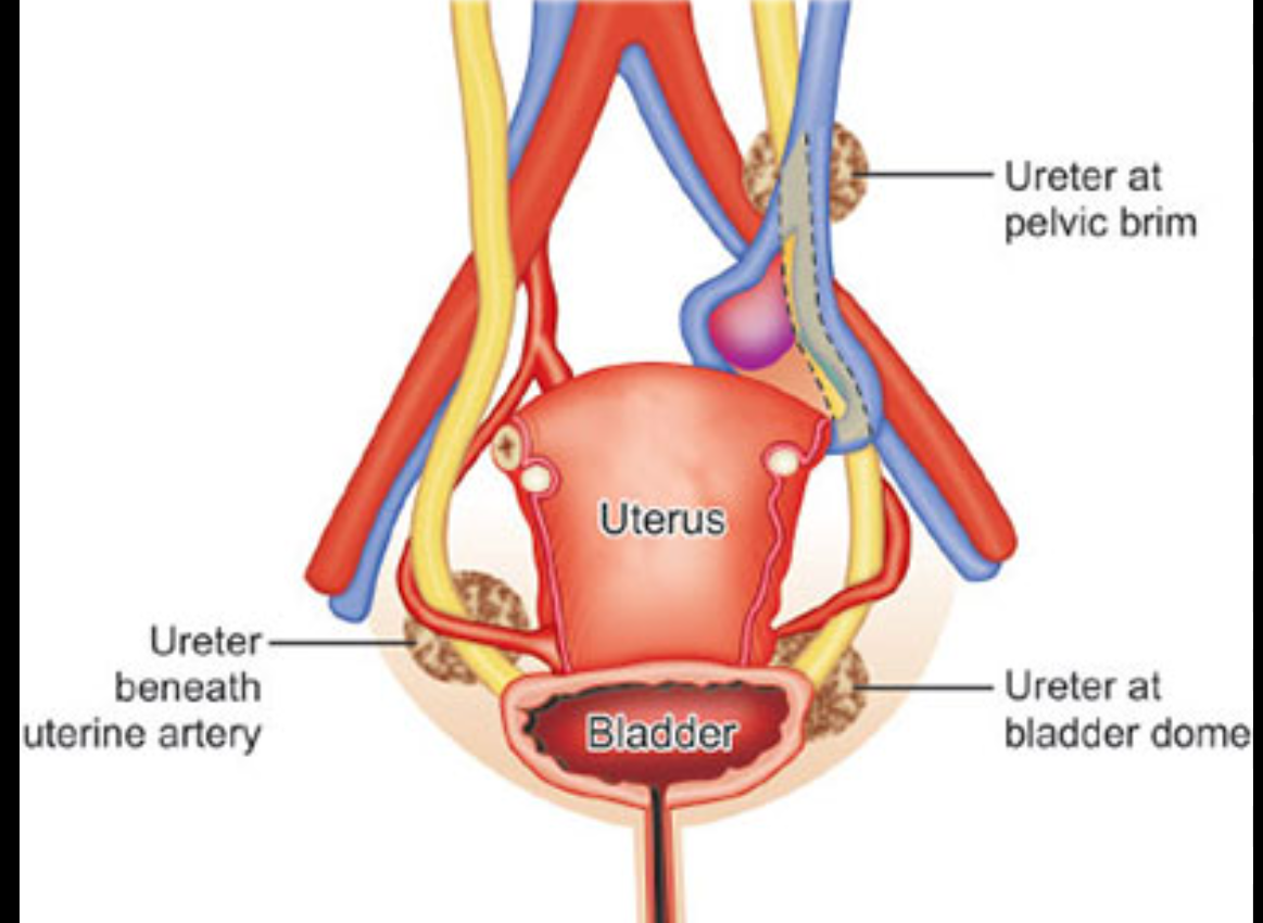 <p>where ureter crosses the iliac vessels</p>
