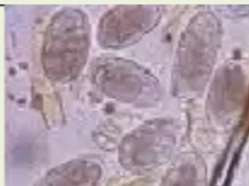 <p>Identify</p>