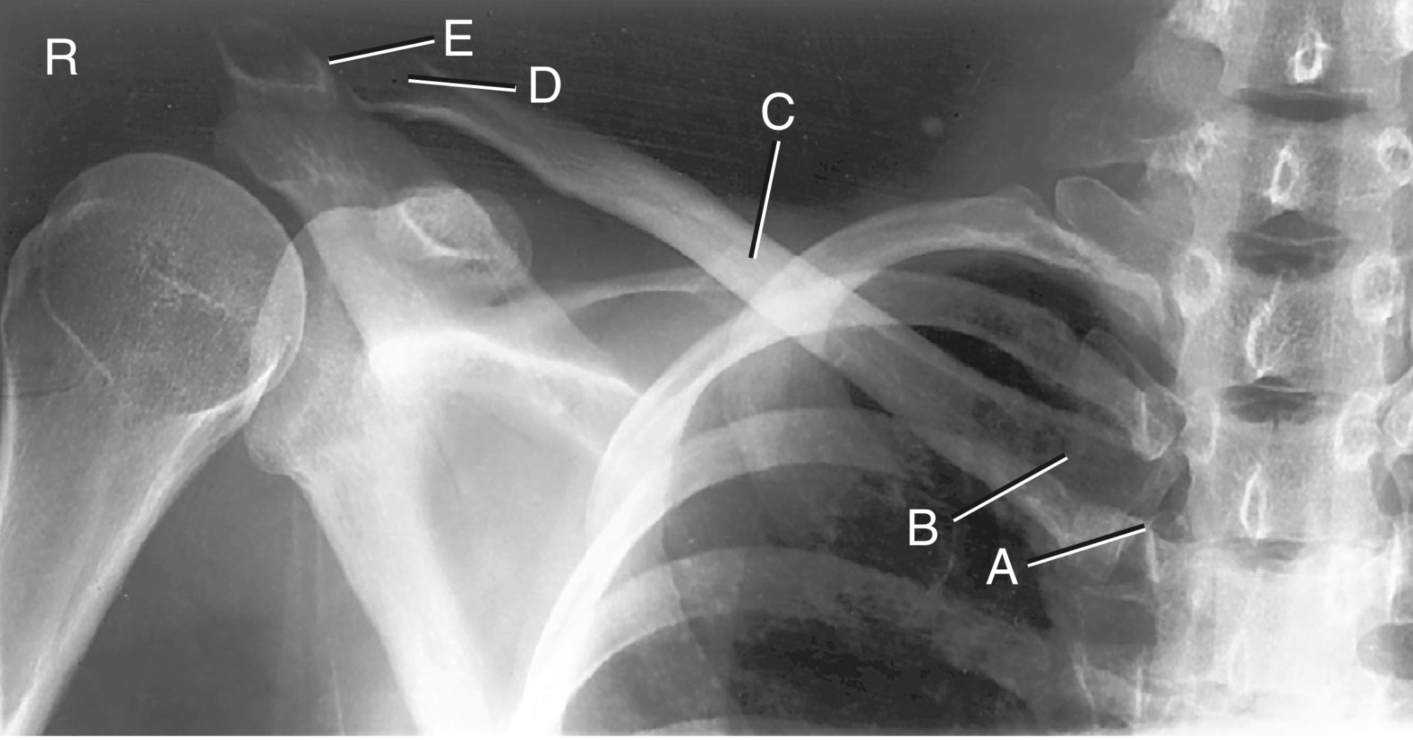 <p>E</p>