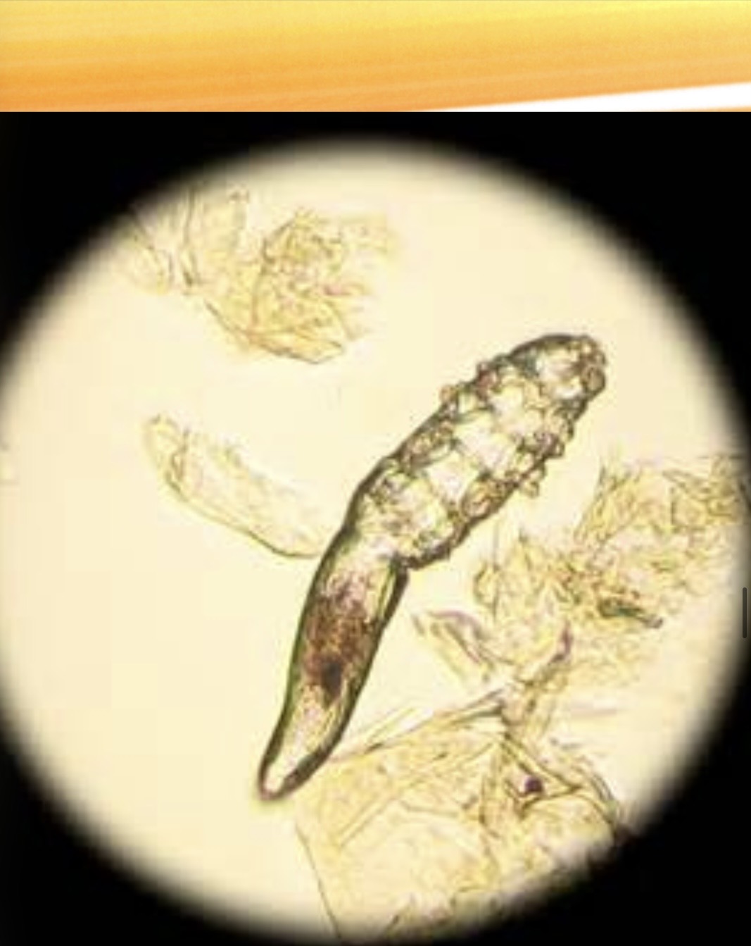 <img src="blob:null/a86f4bf4-fccf-49a1-b5ed-a353c31820b7" width="300" height="300"><p>Deep in hair follicles or sebaceous glands</p>