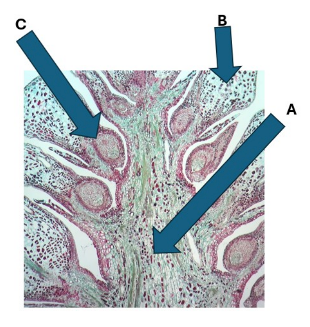 <p>What structure is labeled A?</p>